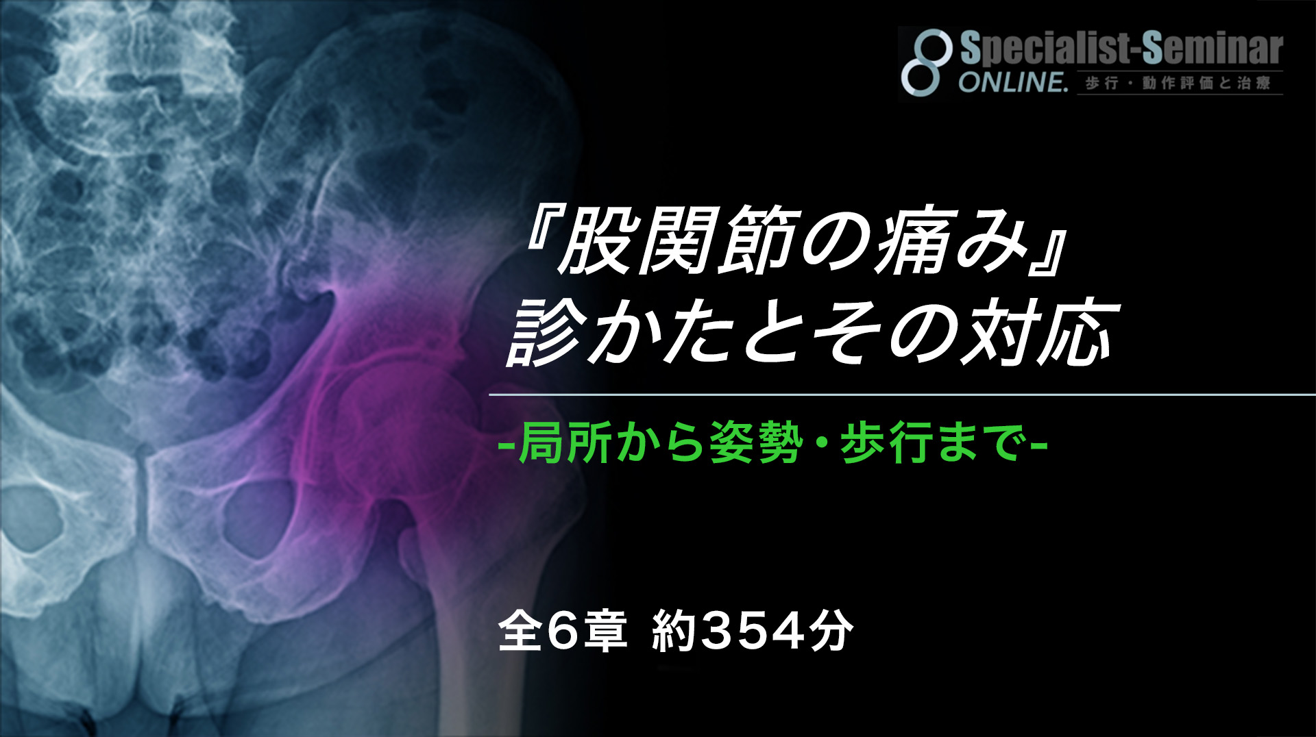 股関節の痛み 診かたとその対応